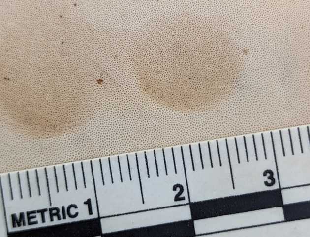 Pore Surface