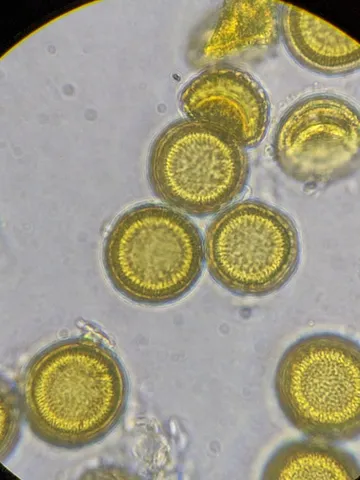 undefined (Elaphomyces spp.)