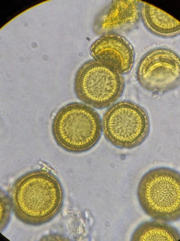 undefined (Elaphomyces sp.)