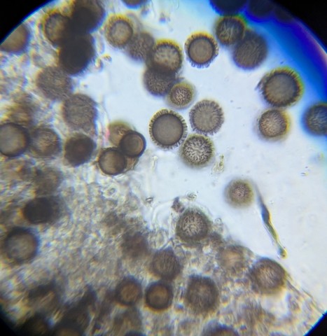 undefined (Elaphomyces dalemurphyi)