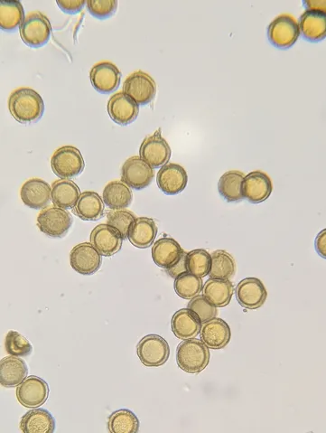 undefined (Elaphomyces spp.)