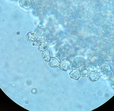 undefined (Entoloma sp. 'IN56')