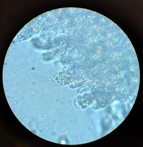 undefined (Entoloma sp. 'IN56')