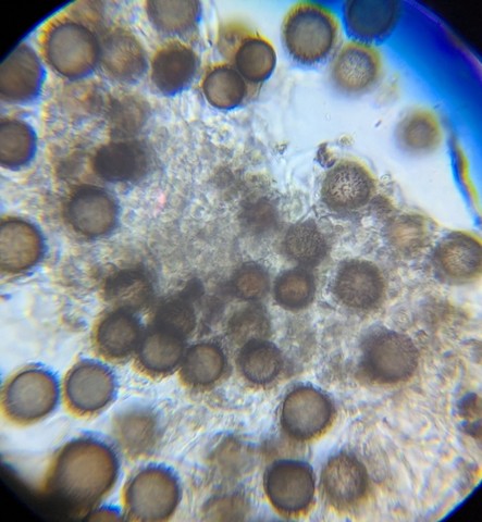 undefined (Elaphomyces dalemurphyi)