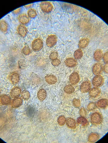 undefined (Hymenogaster spp.)