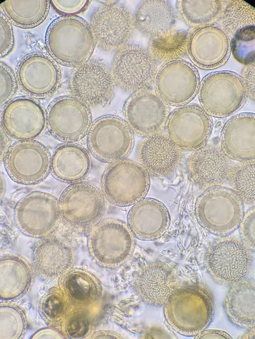 undefined (Elaphomyces spp.)