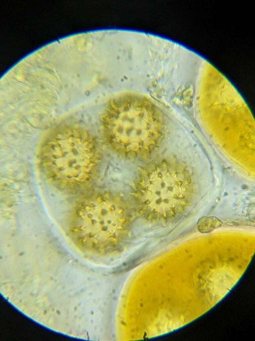 Truffles (Tuber sp.)