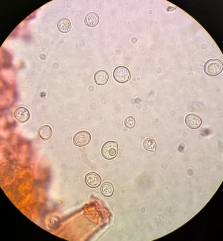 undefined (Pluteus septocystidiatus)