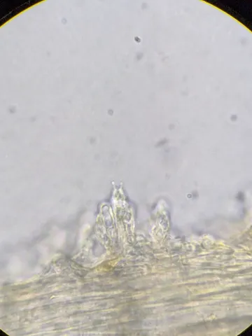 undefined (Cystolepiota cystidiosa)