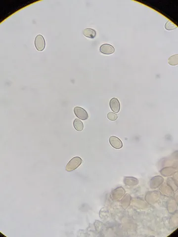 undefined (Leucoagaricus sp. 'IN03')