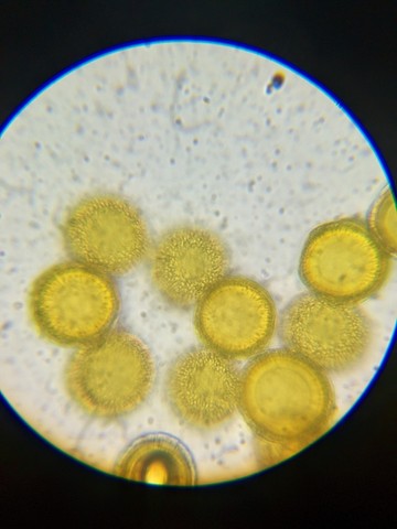 undefined (Elaphomyces sp.)