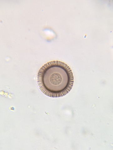 undefined (Elaphomyces sp.)