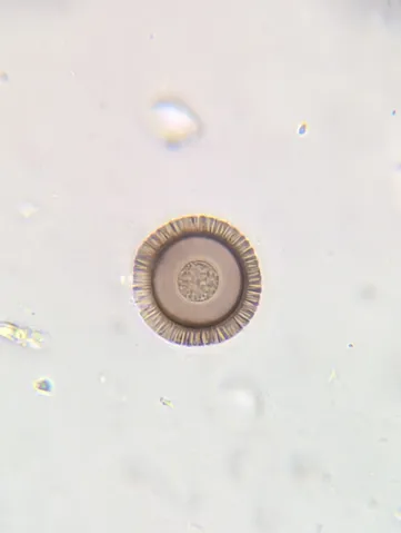 undefined (Elaphomyces spp.)