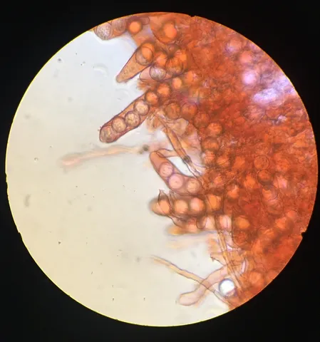 undefined (Densocarpa shanorii)
