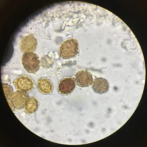 undefined (Hymenogaster spp.)