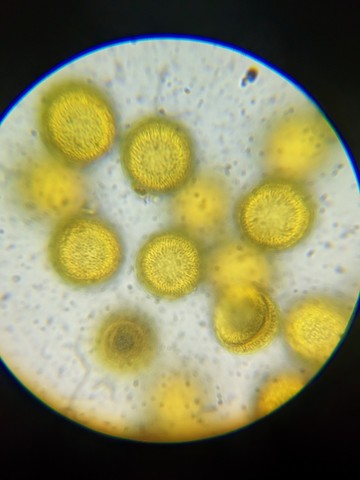 undefined (Elaphomyces sp.)