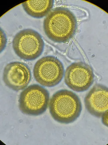 undefined (Elaphomyces spp.)