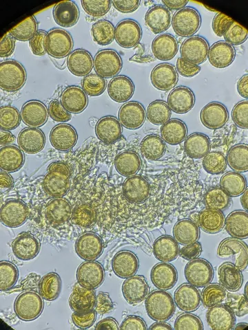 undefined (Elaphomyces spp.)