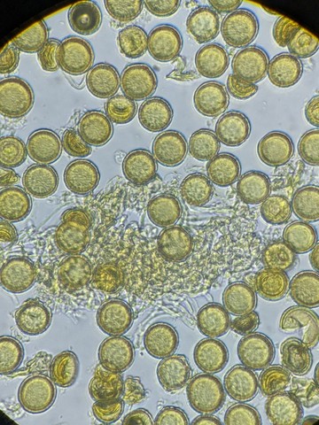 undefined (Elaphomyces sp.)