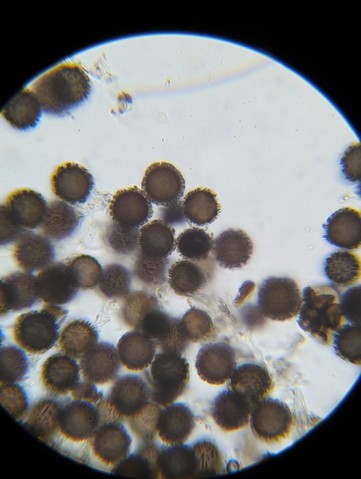 undefined (Elaphomyces sp.)