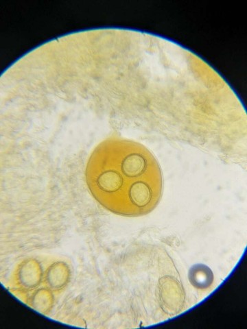 Truffles (Tuber sp.)