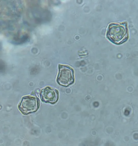 undefined (Entoloma sp. 'IN56')