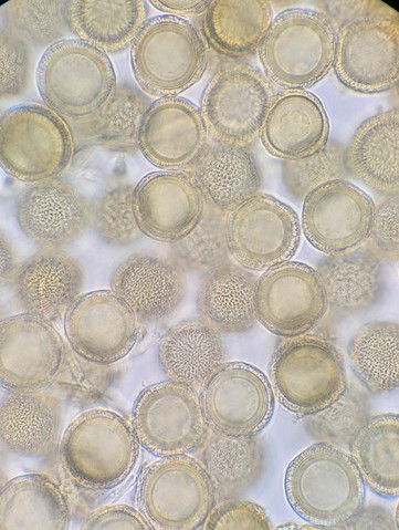 undefined (Elaphomyces sp.)