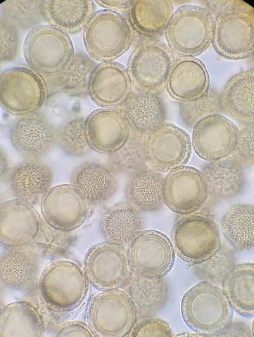 undefined (Elaphomyces spp.)