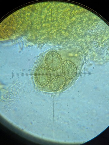 undefined (Tuber rugosum)