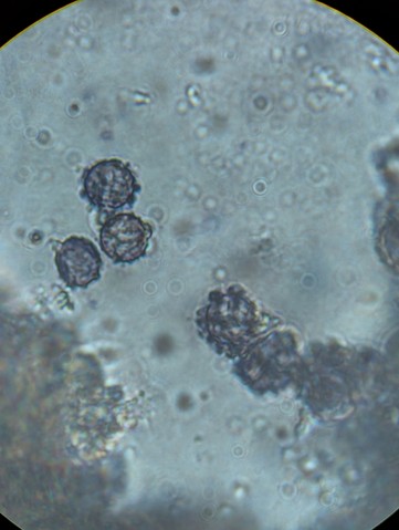 Common Milkcaps (Lactarius sp.)