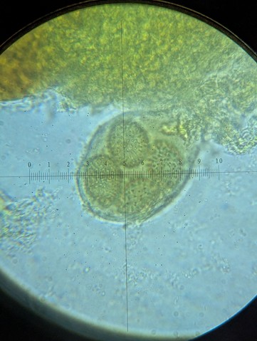 undefined (Tuber rugosum)