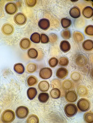 undefined (Elaphomyces spp.)