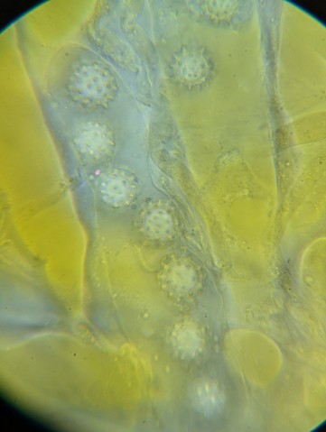 undefined (Pachyphlodes carnea)