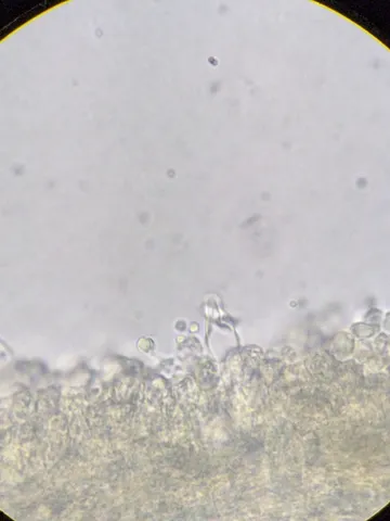 undefined (Cystolepiota cystidiosa)