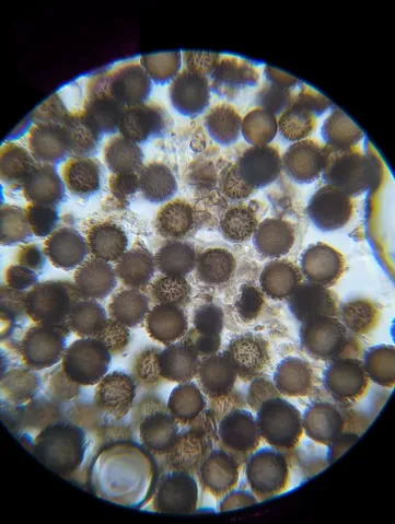 undefined (Elaphomyces spp.)