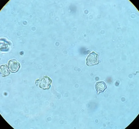 undefined (Entoloma sp. 'IN56')