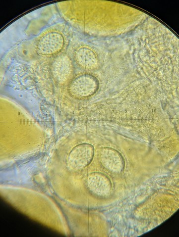 undefined (Tuber rugosum)