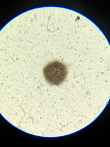 undefined (Elaphomyces spp.)