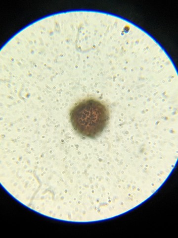 undefined (Elaphomyces sp.)