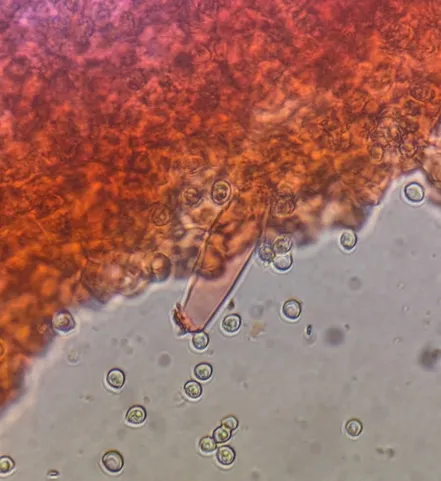 undefined (Pluteus septocystidiatus)